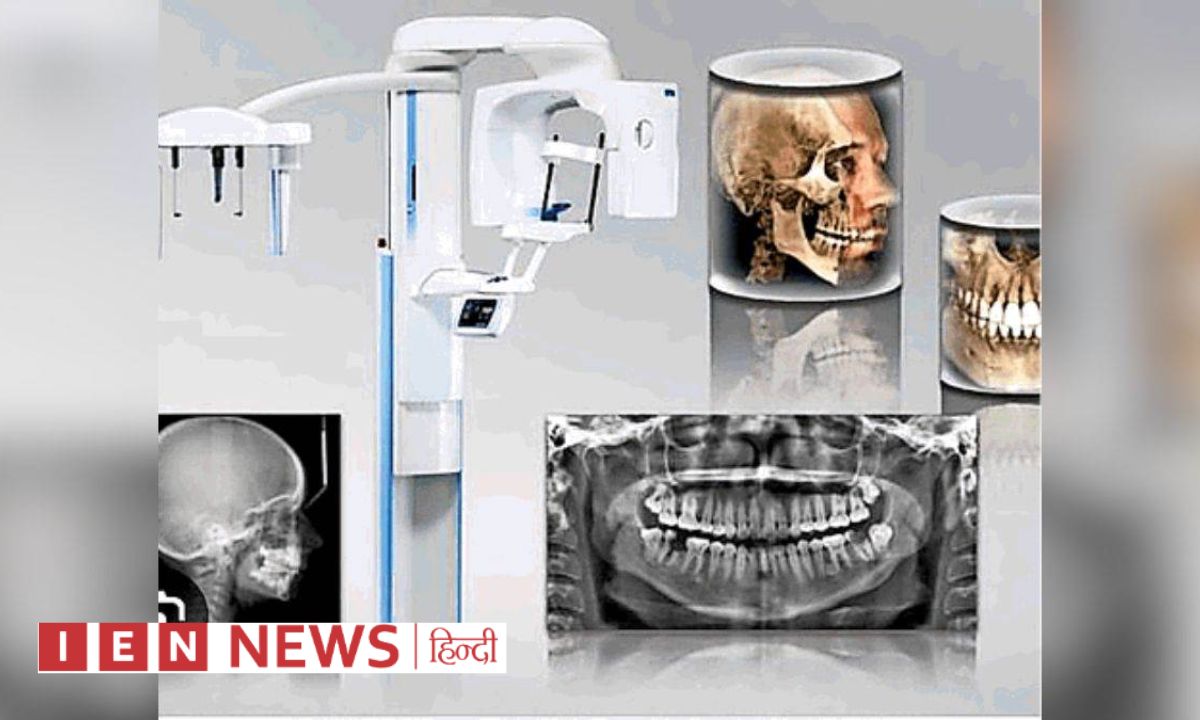 डेंटल कालेज में CBCT मशीन से जबड़ों की होगी 3D स्कैनिंग, इलाज होगा आसान